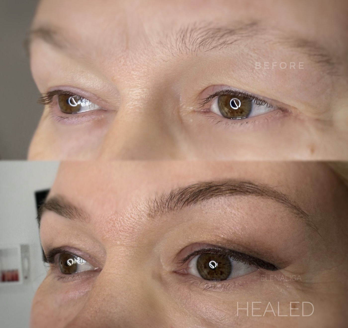 Before and healed: Lifting Eyeshadow on a hooded eyelid